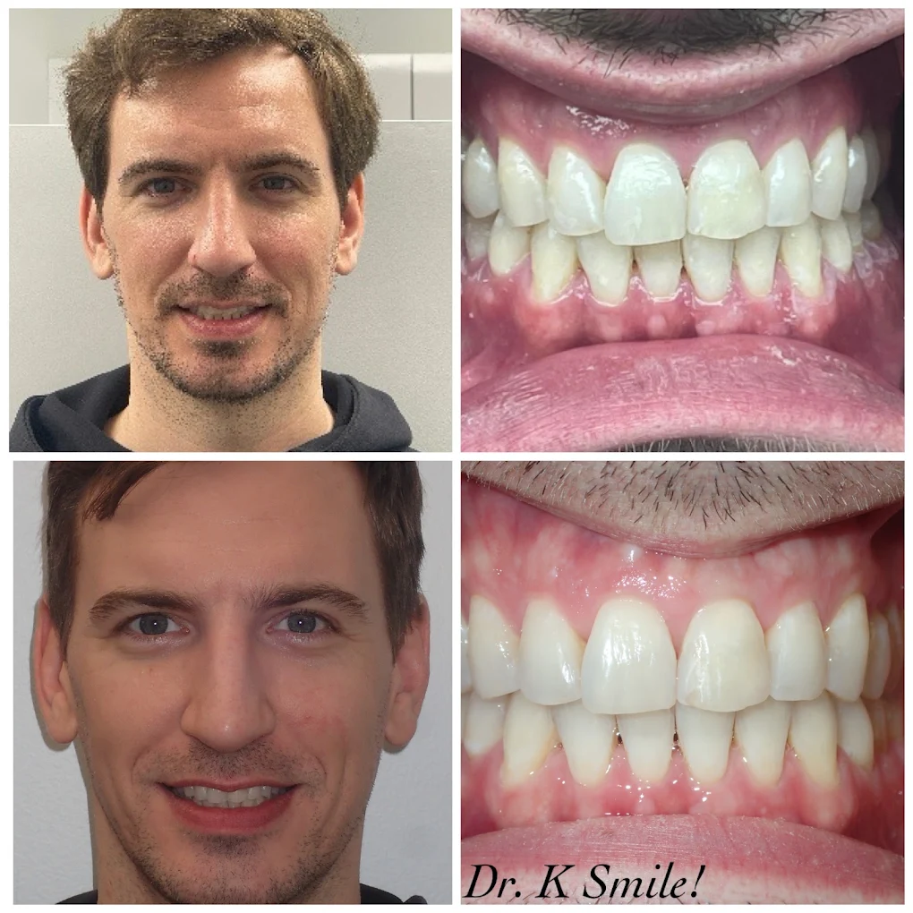 Before and after smile results for a patient of Dr. Karbasi