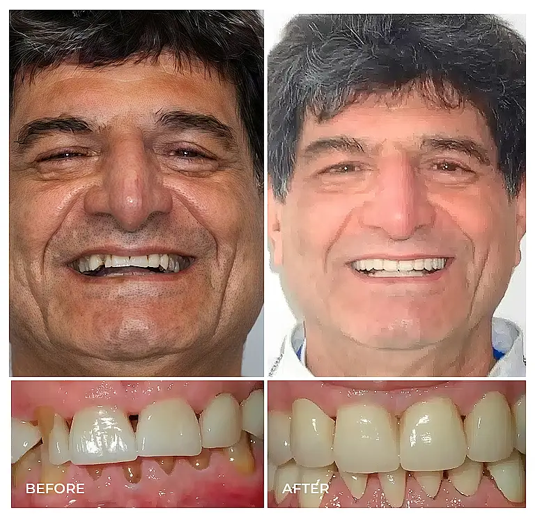 reston heights smile gallery 05