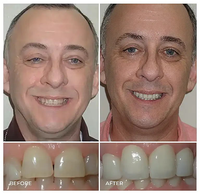 reston heights smile gallery 14