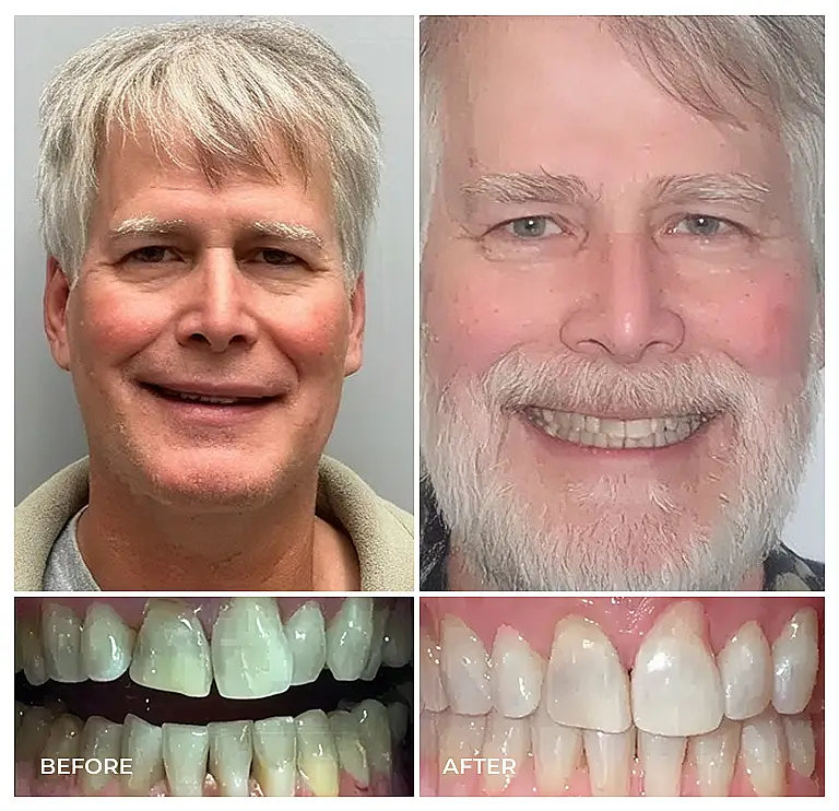 reston heights smile gallery 17