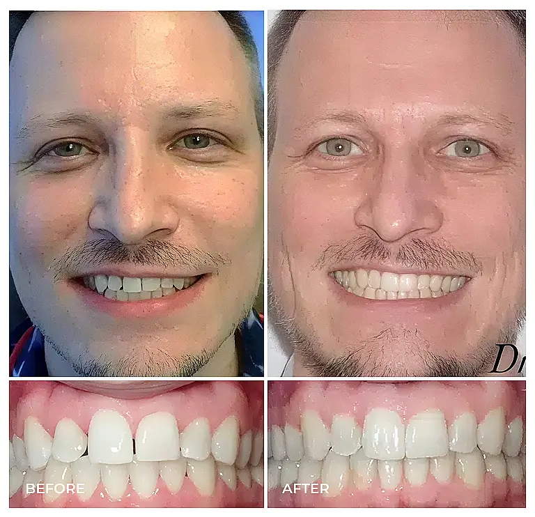 reston heights smile gallery 18
