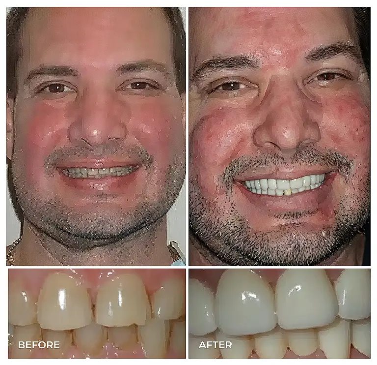 reston heights smile gallery 20
