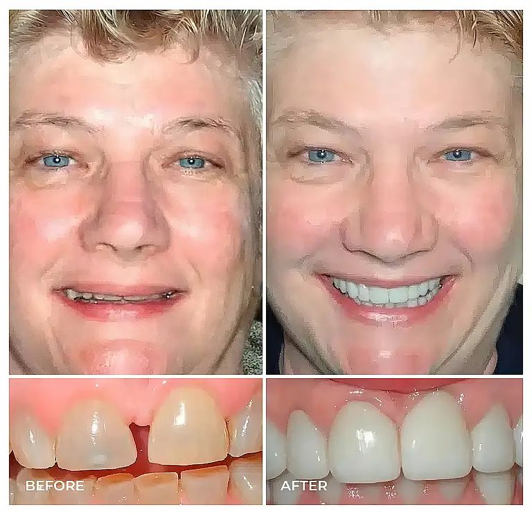 reston heights smile gallery 24