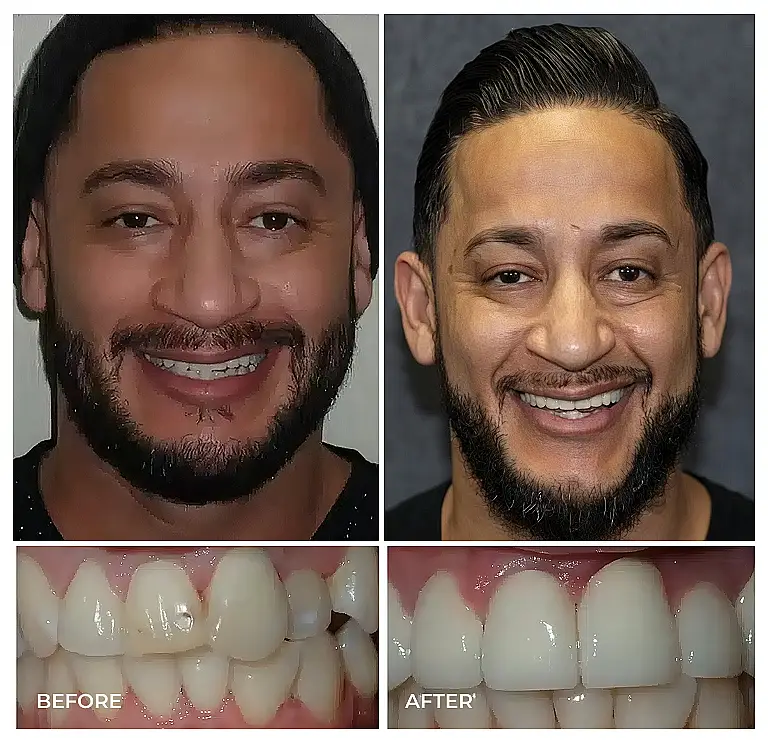 reston heights smile gallery 26