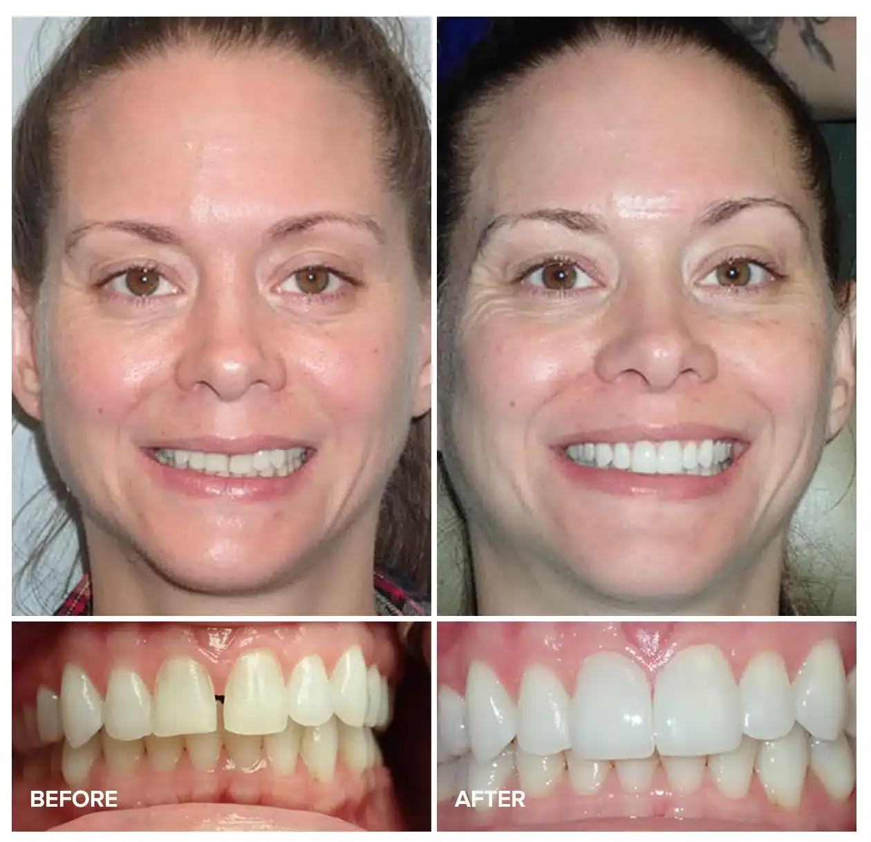 Before and after cosmetic treatment