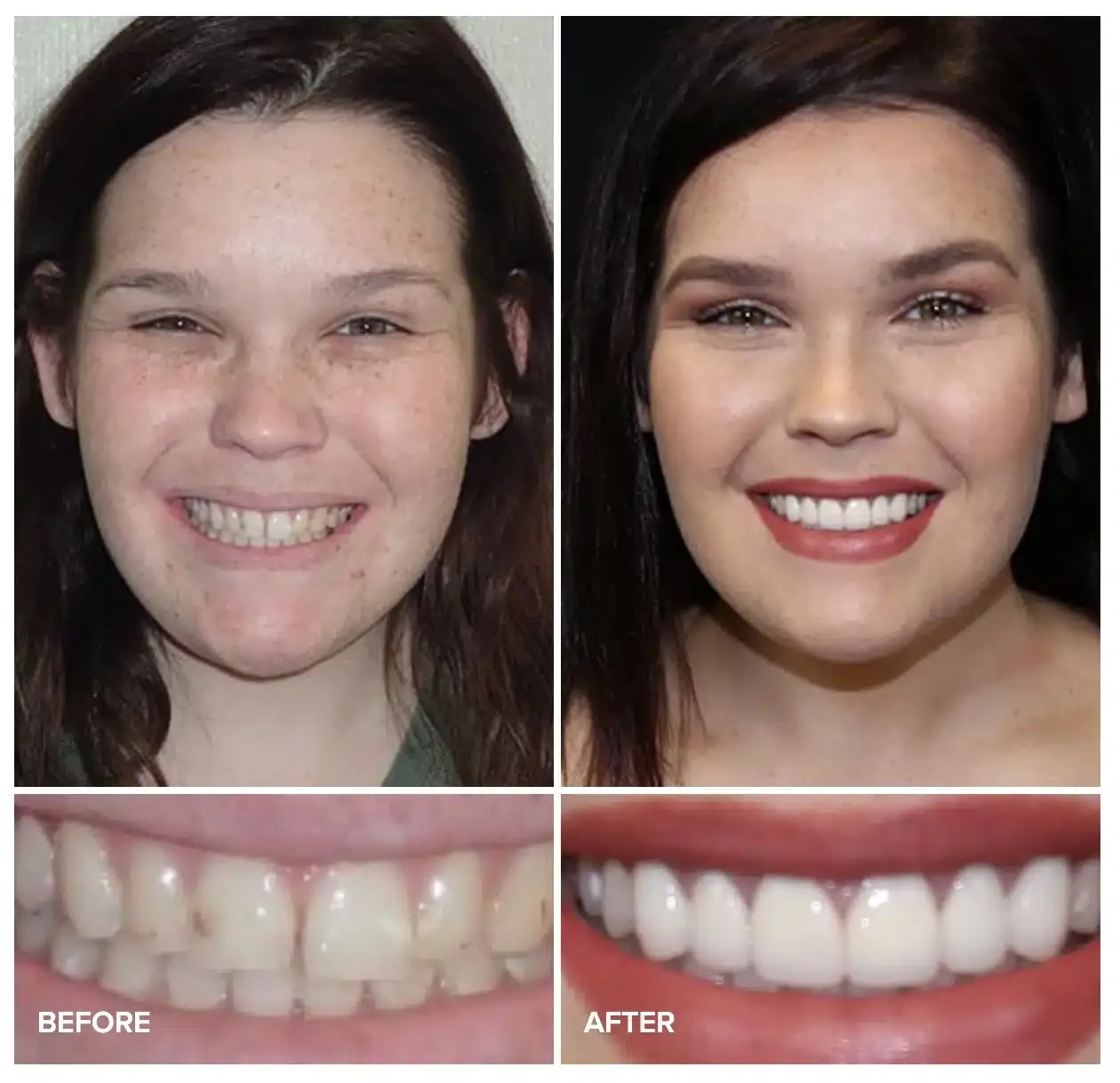 Before and after cosmetic treatment