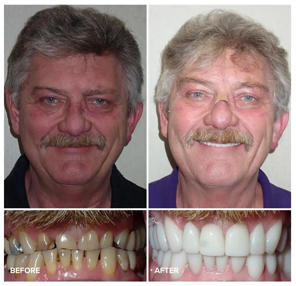 Before and after cosmetic treatment