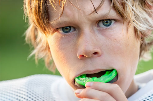 Stay Game Ready With Custom Mouthguards