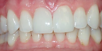 Image for 