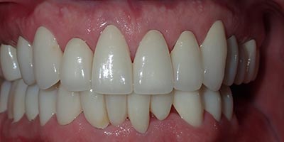 Image for 