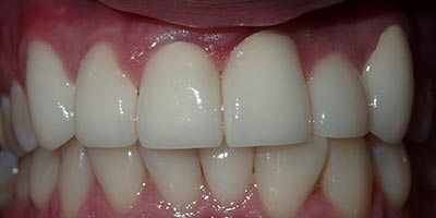 Image for 