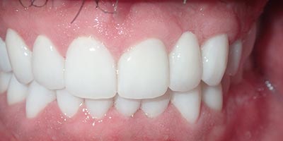 Image for 