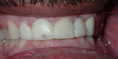 Image for 