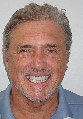 Image for 