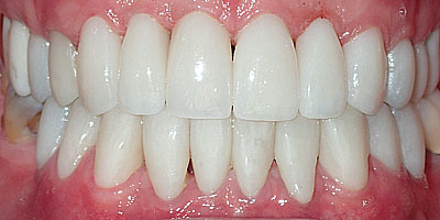 Image for 