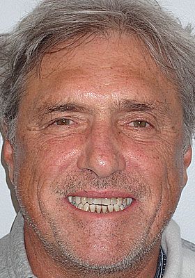 Image for 