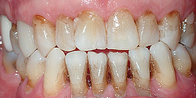 Image for 